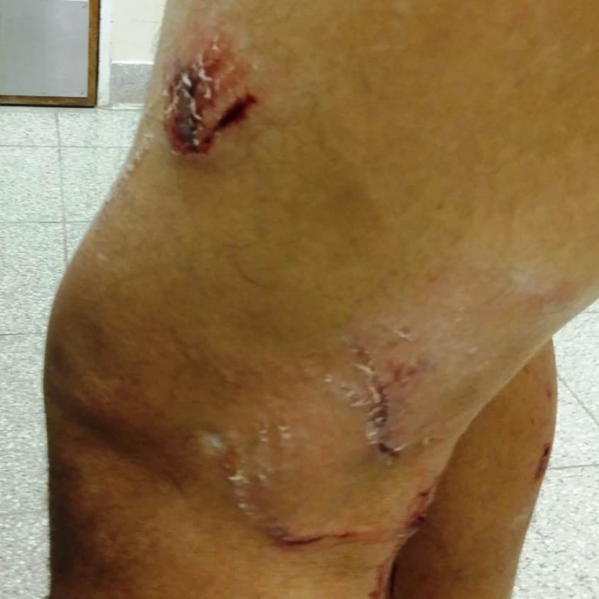 Un hombre sufri&oacute; serias heridas al ser atacado por una jaur&iacute;a 