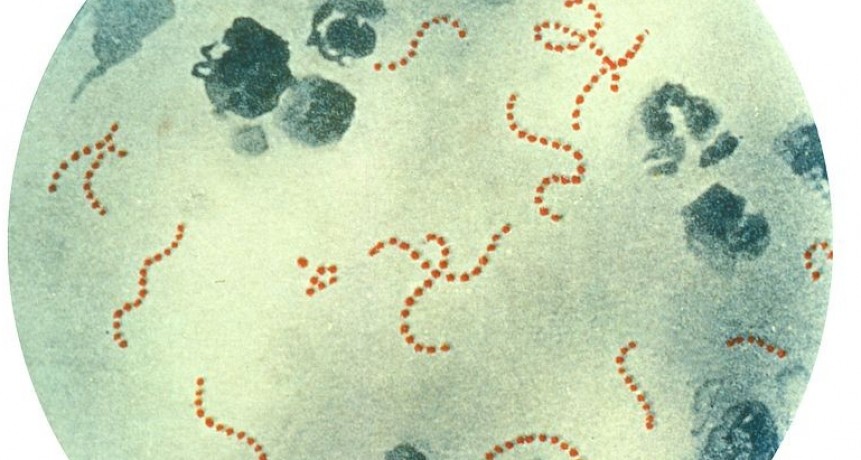 Streptococcus, la palabra que asusta tambi&eacute;n en El Calafate