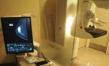 Desde el lunes funciona el nuevo mam&oacute;grafo en el SAMIC